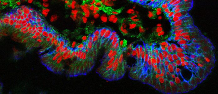 I-CAMBIAMENTI-DEL-NOSTRO-UMORE….TUTTA-UNA-QUESTIONE-DI-MICROBI-