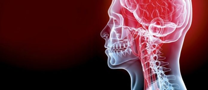 ictus Nell’uso comune del termine ictus, si è soliti indicare una patologia, ma, più che essere tale, la parola dovrebbe indicare un evento di ordine clinico.